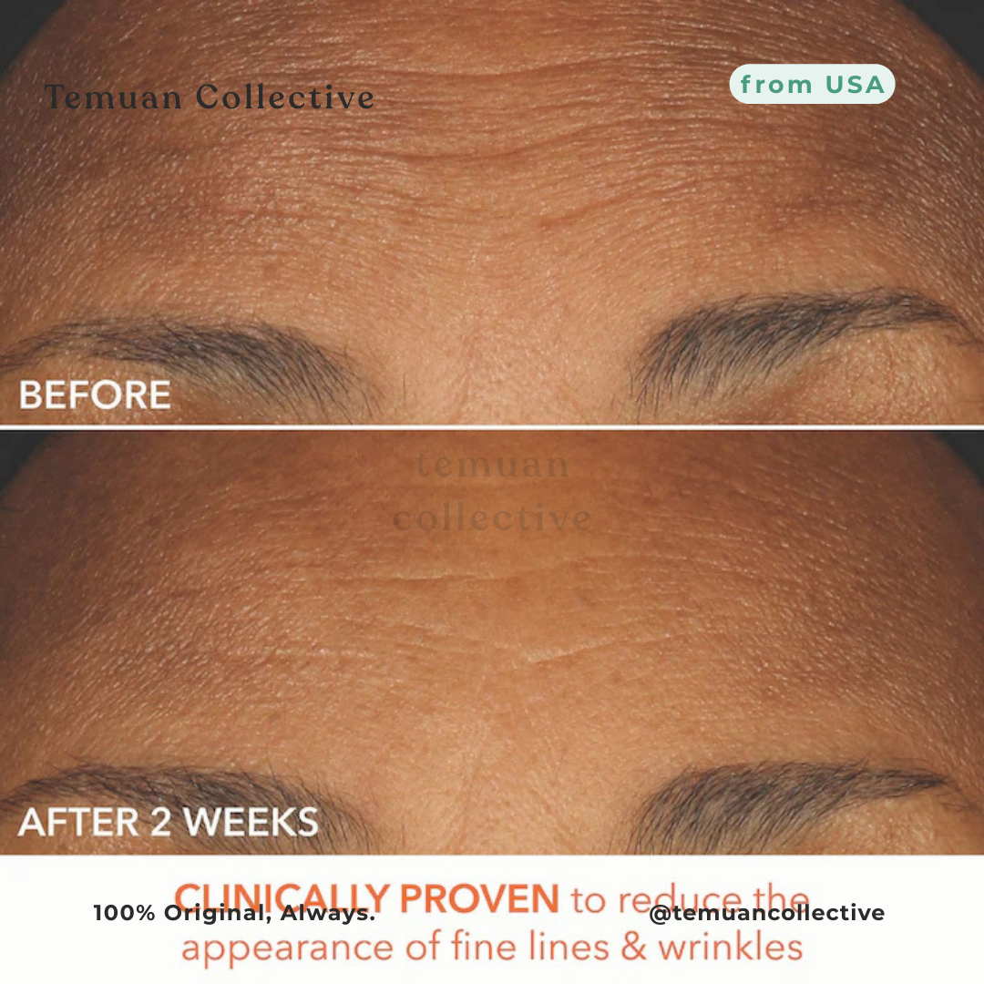 Dr. Dennis Gross Alpha Beta Extra Strength Peel