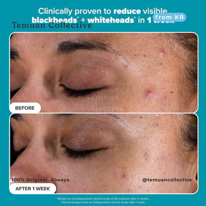 Paula’s Choice Skin Perfecting 2% BHA Exfoliating Toner