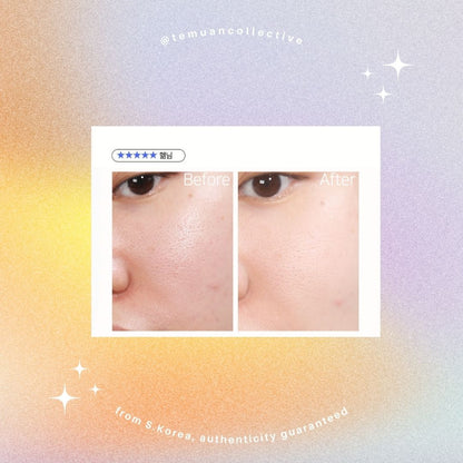 Aperire Spa Relief Be Frozen Pore Face Mask 120g Set