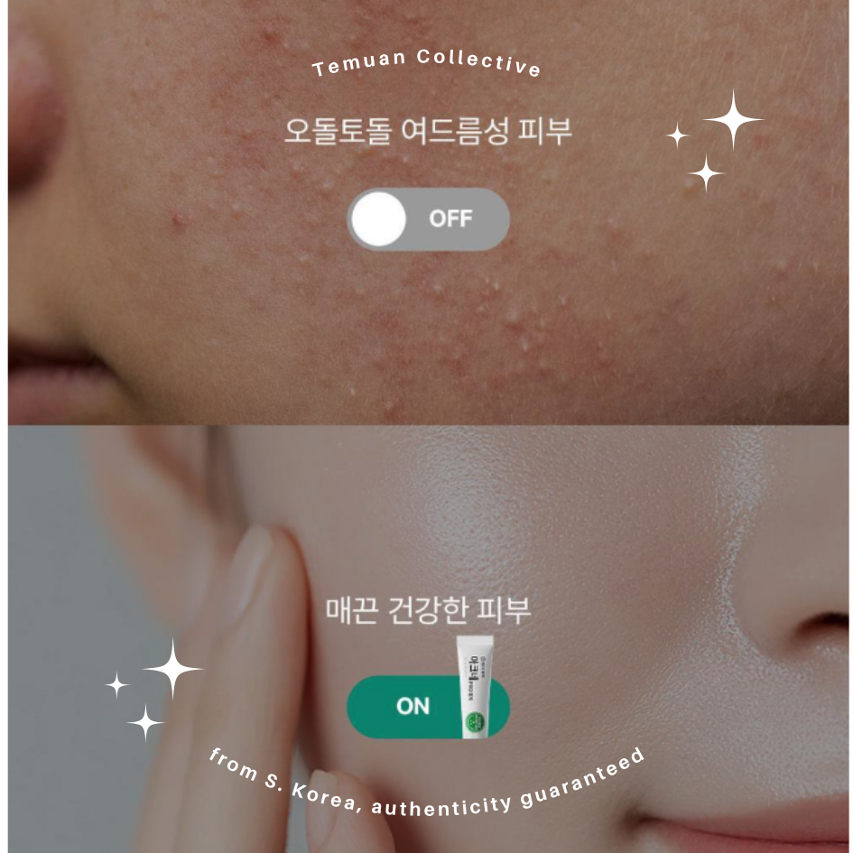 DONG-A PHARM Acne Pro Cream &  Acne Pro Gel