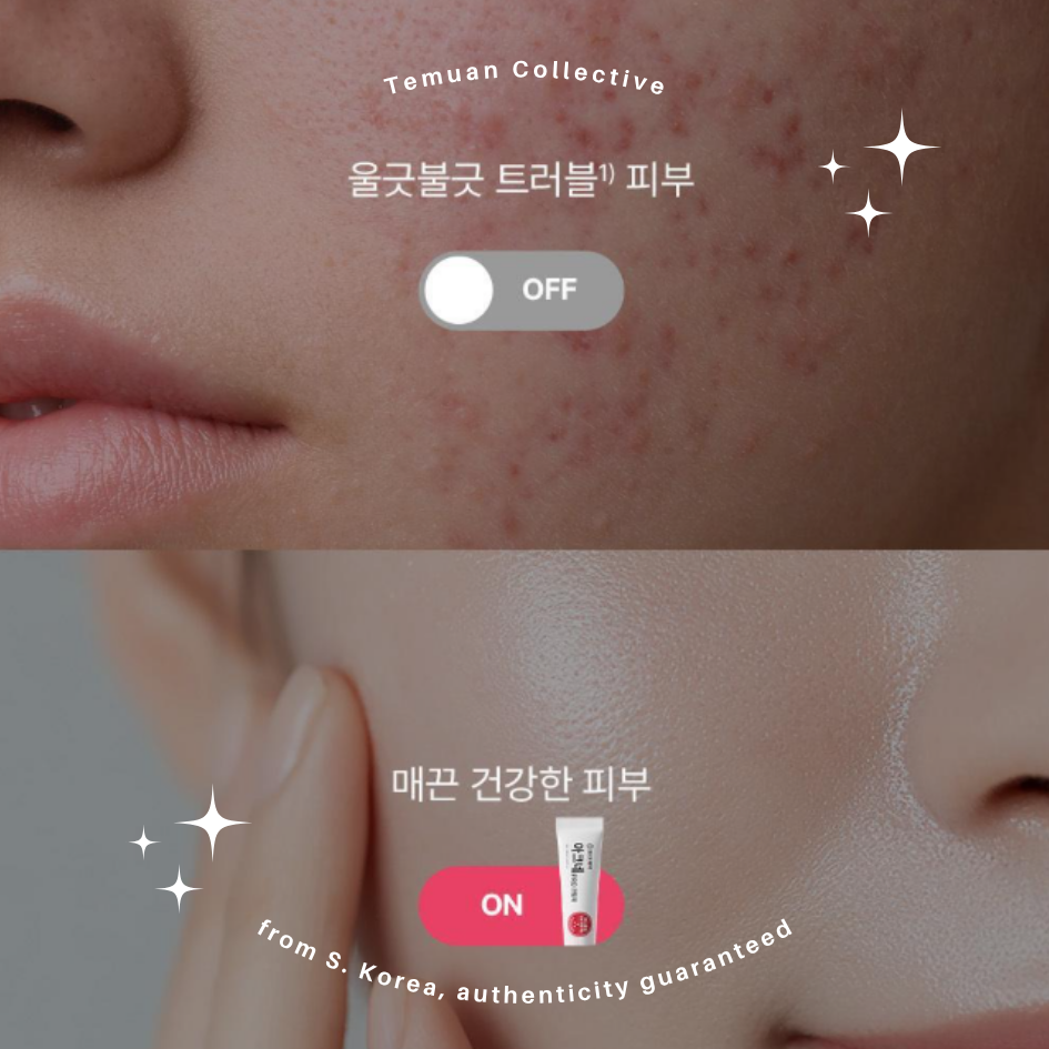 DONG-A PHARM Acne Pro Cream &  Acne Pro Gel