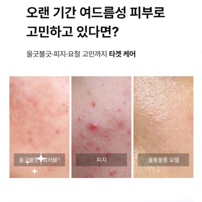 DONG-A PHARM Acne Pro Cream &  Acne Pro Gel