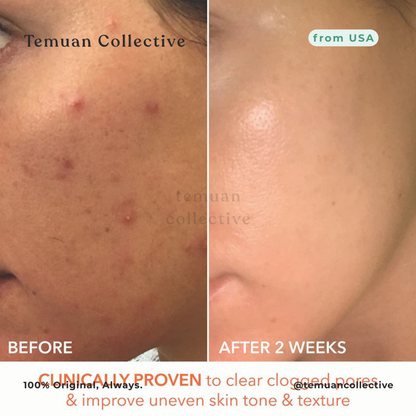 Dr. Dennis Gross Alpha Beta Extra Strength Peel