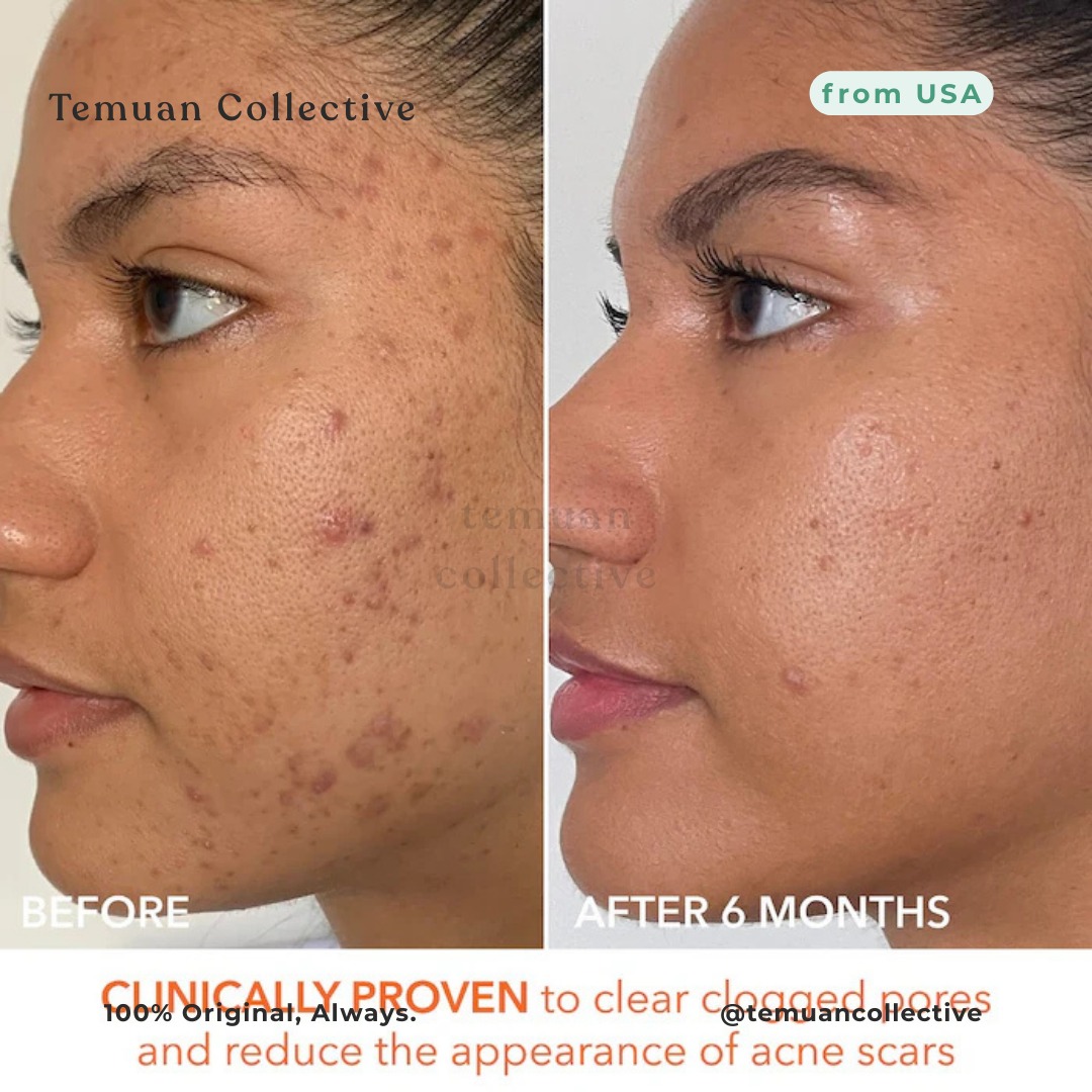 Dr. Dennis Gross Alpha Beta Extra Strength Peel