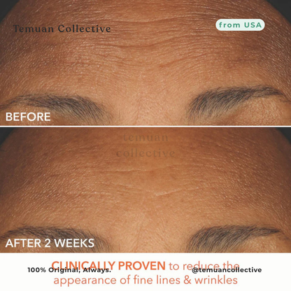 Dr. Dennis Gross Alpha Beta Extra Strength Peel