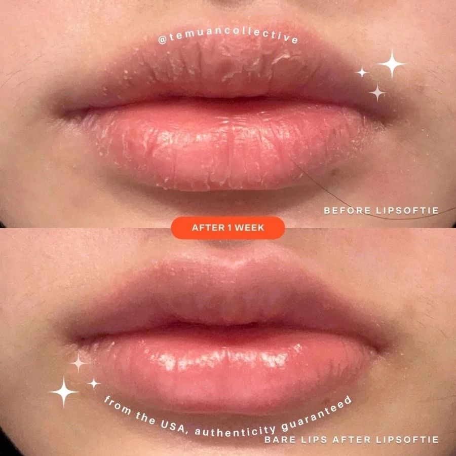 Tower 28 LipSoftie Lip Treatment