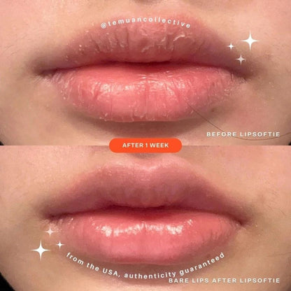 Tower 28 LipSoftie Lip Treatment