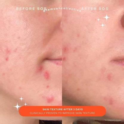 Tower 28 SOS Recovery Cream