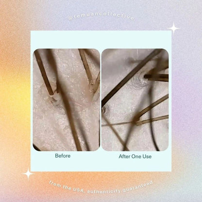 NUTRAFOL Root Purifier Scalp Shampoo for Thinning Hair